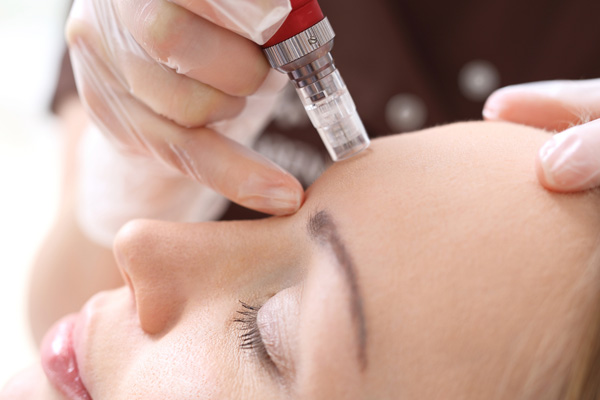 Advanced Micro Needling from Skin Confidence Pro
