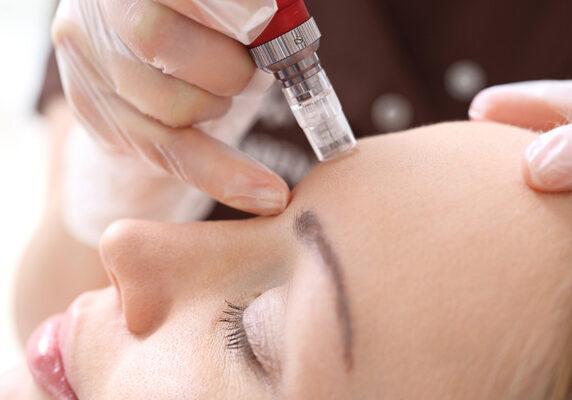 Advanced Micro Needling from Skin Confidence Pro